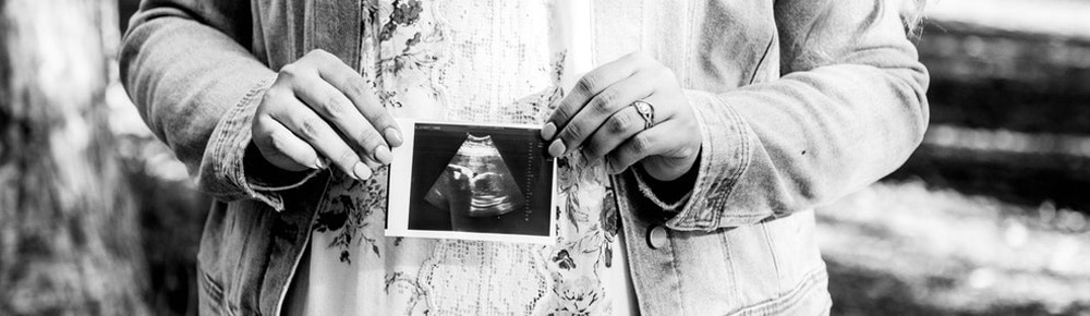 lady holds an ultrasound photo